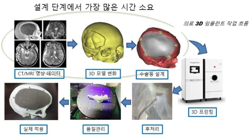 인공지능 기술을 이용해 의료 3D 프린팅 모델을 제작하는 과정 모식도