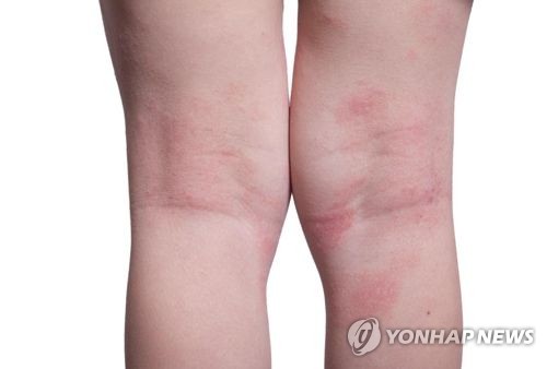 C0A8CAE20000015BE5911F9E00000002_P2.jpg [게티이미지뱅크