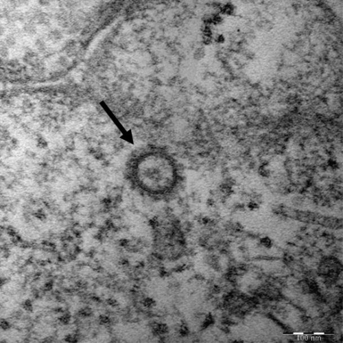 电子显微镜下的新冠病毒高清图像 韩国疾病管理本部供图（图片严禁转载复制）