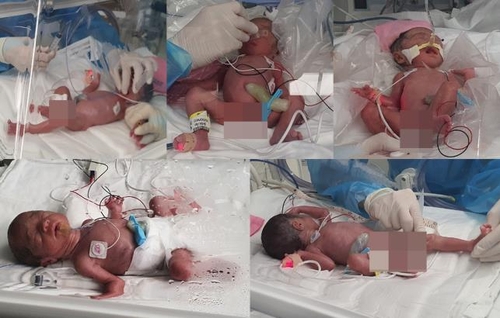 据首尔大学医院11月19日消息，一对来自韩国陆军17师的军人夫妇前一天晚上10时许诞下五胞胎。 首尔大学医院供图（图片严禁转载复制）