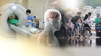 이달부터 단순 두통·어지럼에 함부로 MRI 찍으면 '진료비 폭탄'